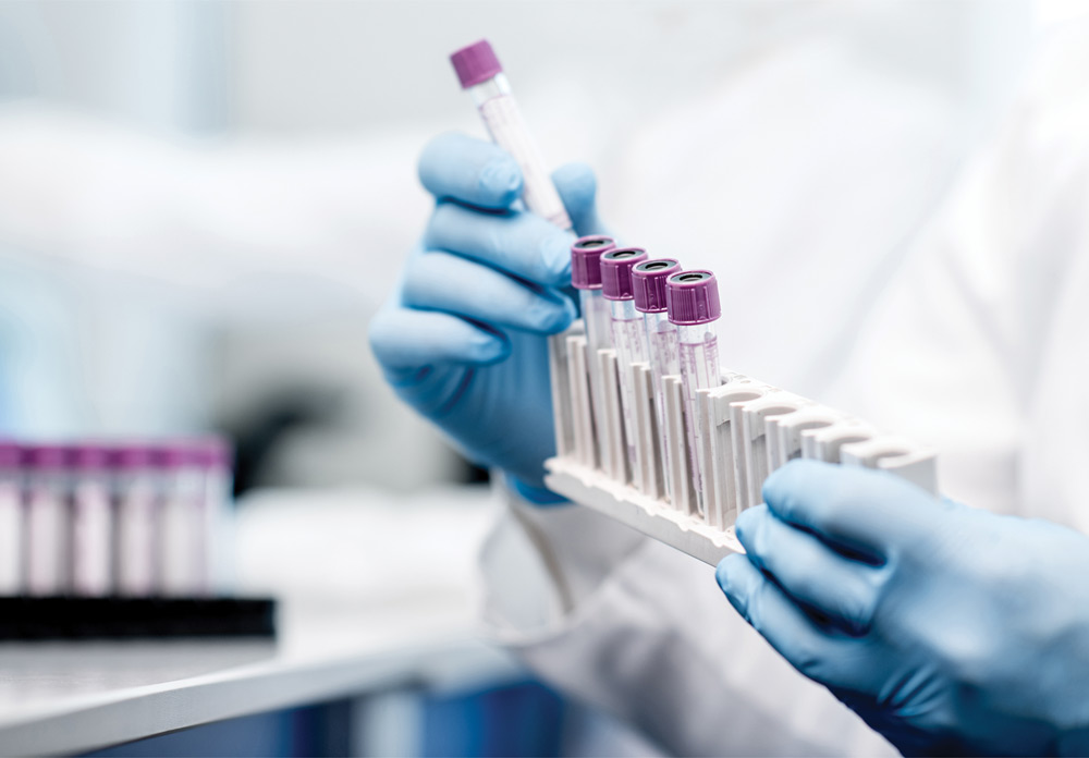 Medical technician holding a rack of blood vials